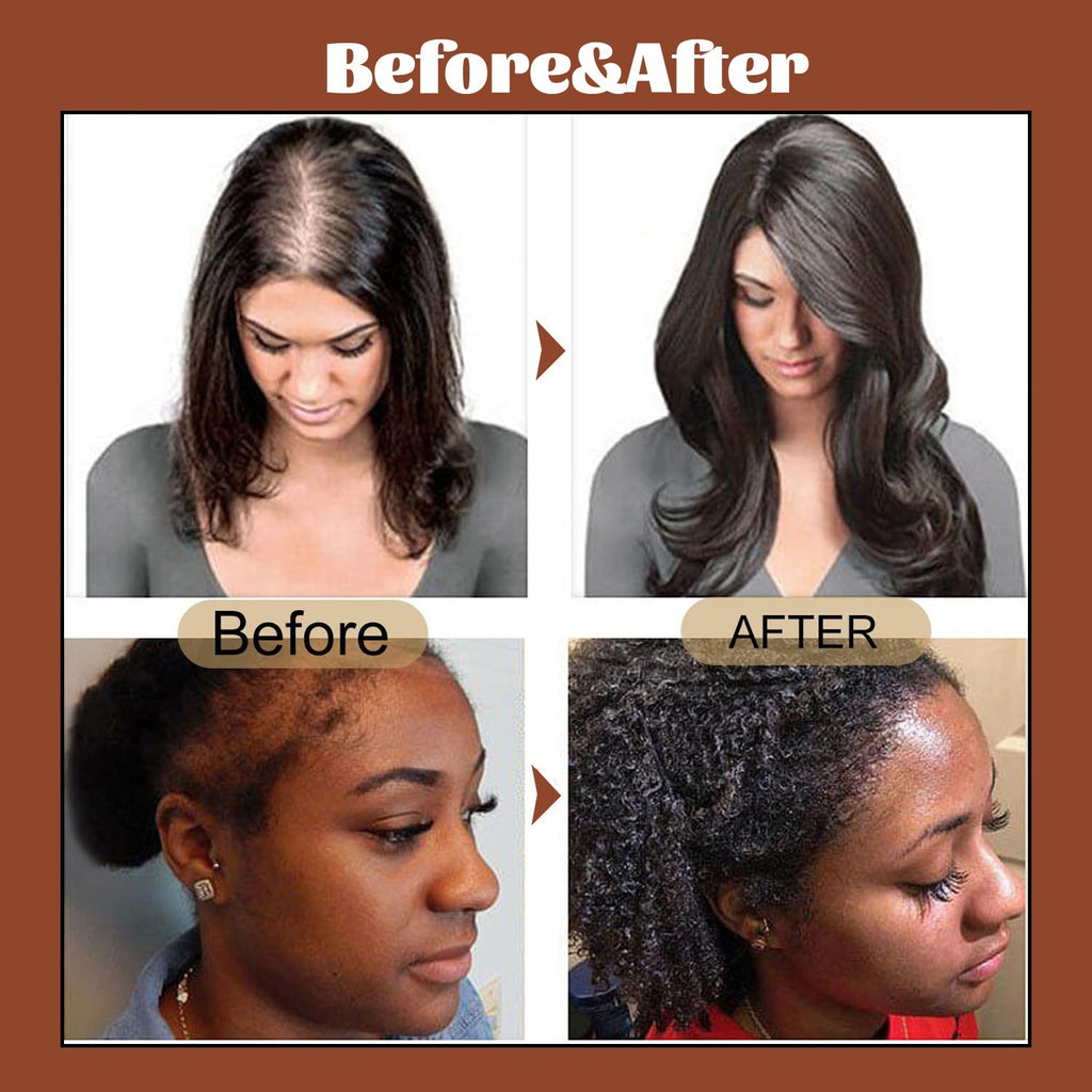 Promote Hair Growth And Care With Hair Oil